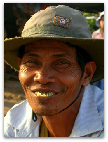 cambodia-man-gold-teeth